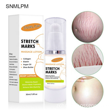 best pregnancy remover removal stretch mark cream